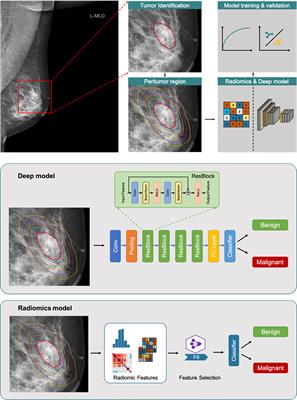 Evaluation of the peritumoral features using radiomics and deep learning technology in non-spiculated and noncalcified masses of the breast on mammography